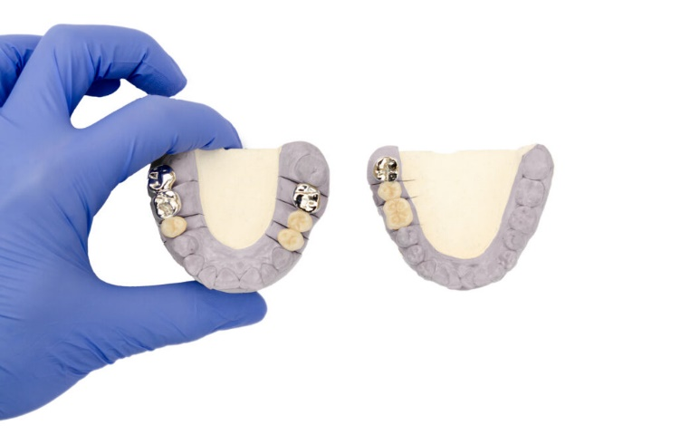 LONGER Research: Innovations in Ray5 20W Laser Engraving for Ceramic Art