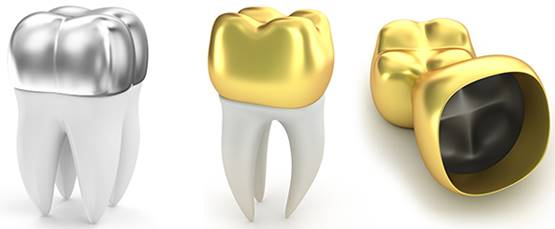 LONGER Research: Innovations in Ray5 20W Laser Engraving for Ceramic Art